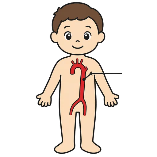 Piktogram AAC: aorta