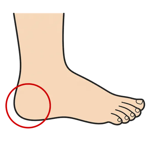 Piktogram AAC: pięta