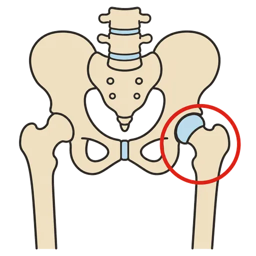 Piktogram AAC: staw biodrowy